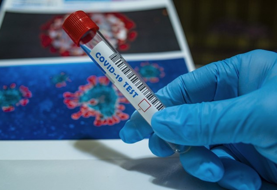 Pará de Minas já registrou 2.268 exames positivos e 63 óbitos pela Covid-19 desde o início da pandemia