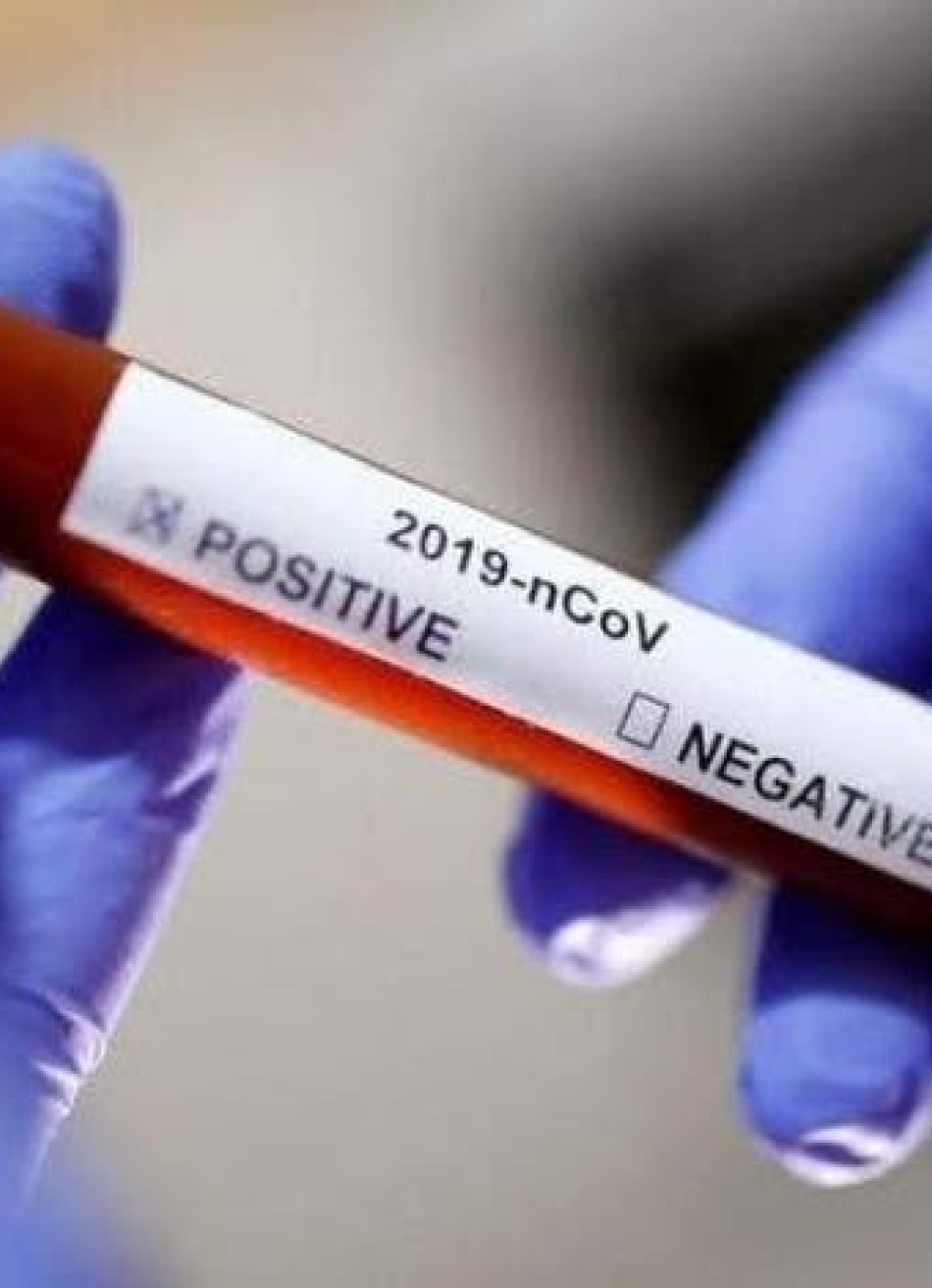 Brasil registrou a segunda maior média móvel de mortes pela Covid-19